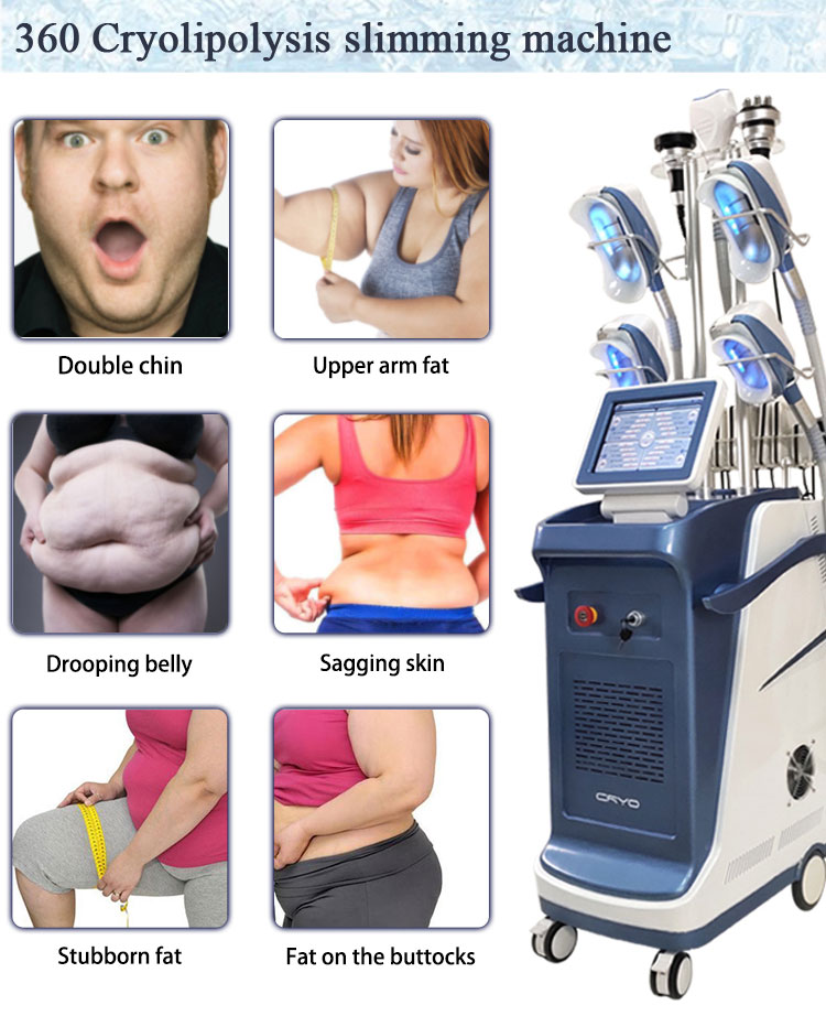 Sales 2021 hot cryo360 cryolipolysis fat freezing slimming machine price