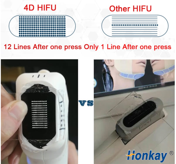 4D high intensity frequency ultrasound fat loss anti-wrinkle equipment