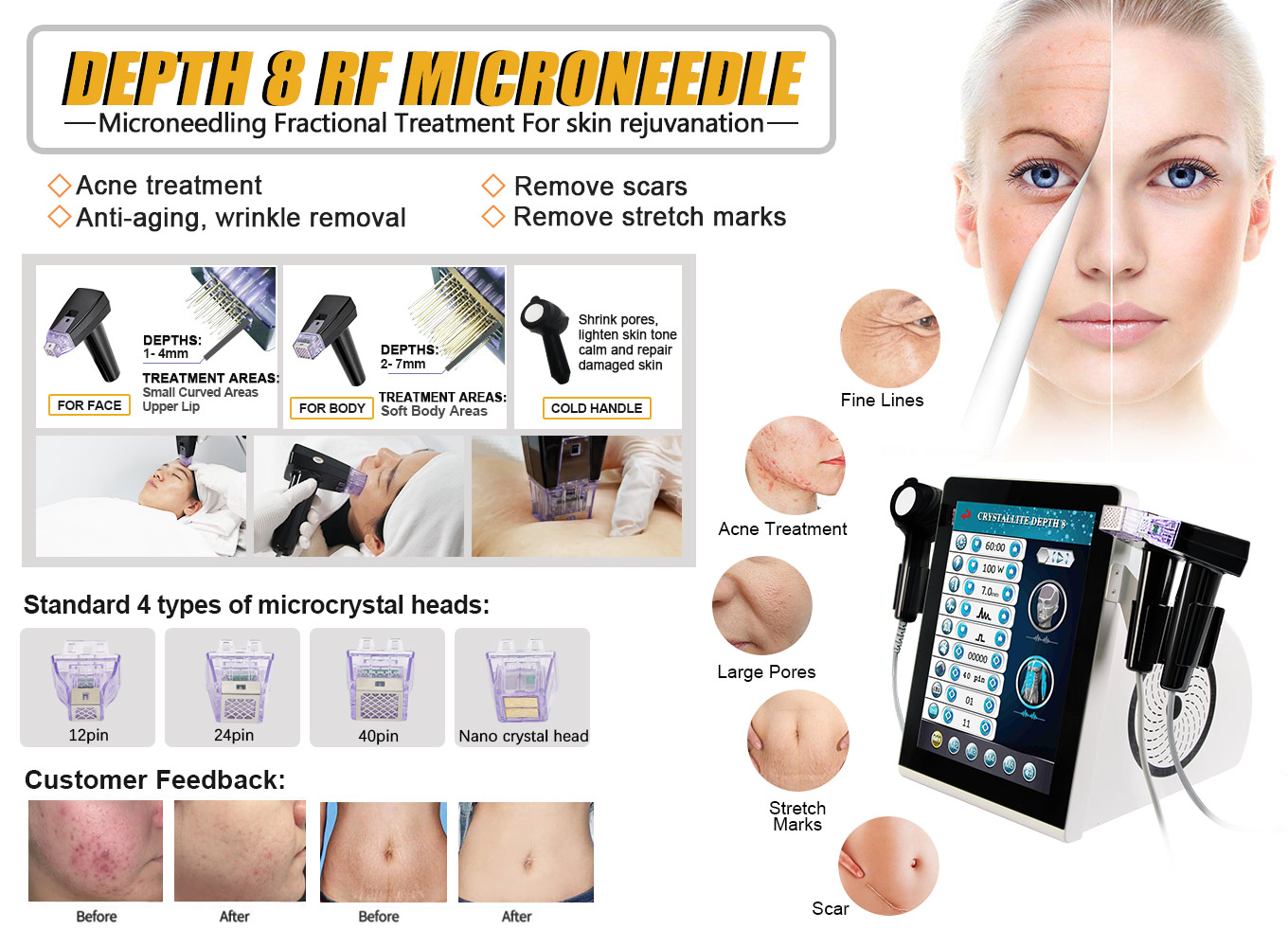 fractional rf microneedling machine